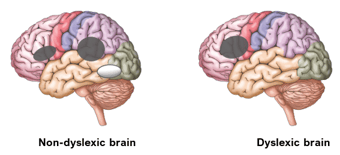 Dyslexic and non-dyslexic